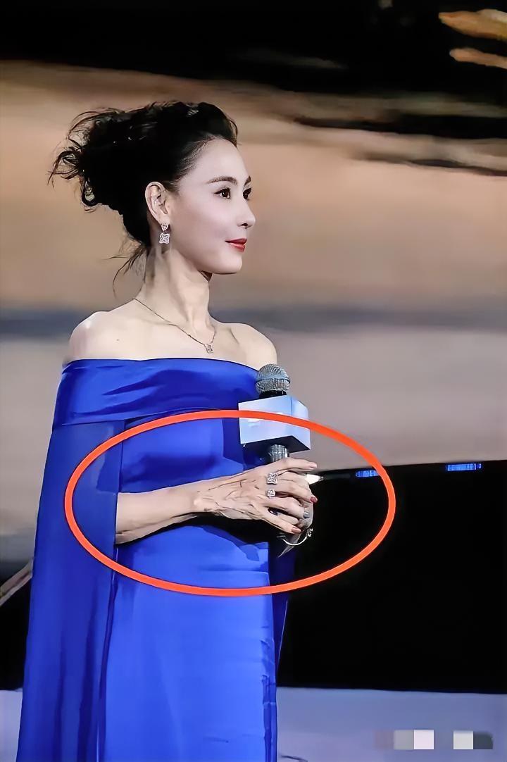 看到张柏芝那双手，真的一下没缓过来——瘦得骨头都突出来，青筋裹着粗糙的皮肤，哪像