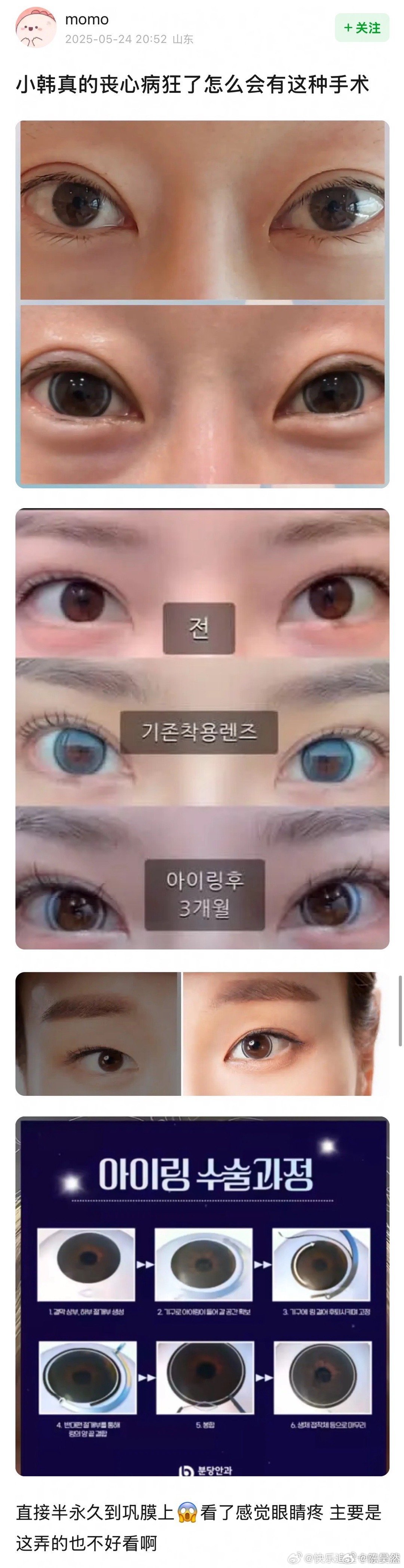 纹美瞳吗？