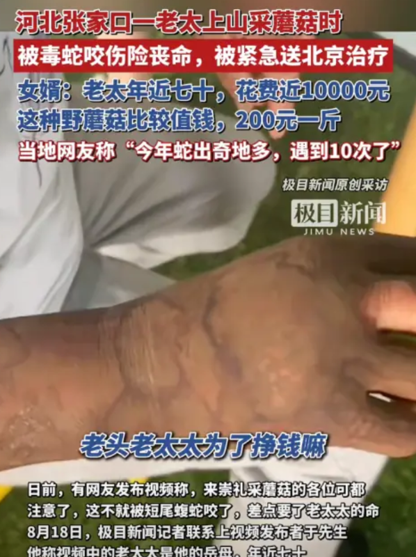 “悲剧还是发生了！”8月15日，河北张家口，一老太上山采蘑菇时，意外被毒蛇咬伤手