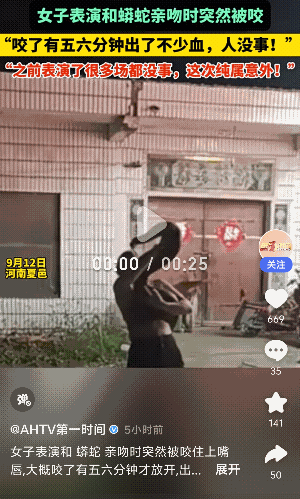 “看着真痛呀”河南夏邑，女子表演和蟒蛇亲吻时，突然被咬五六分钟！血流不少…9