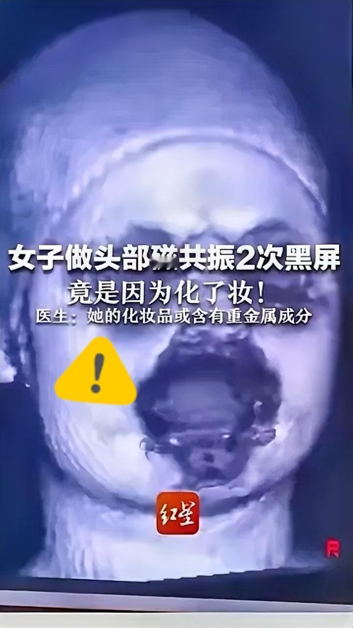 救命！化个淡妆居然让几百万的核磁共振机直接“罢工”？这波操作真是颠覆认知！
