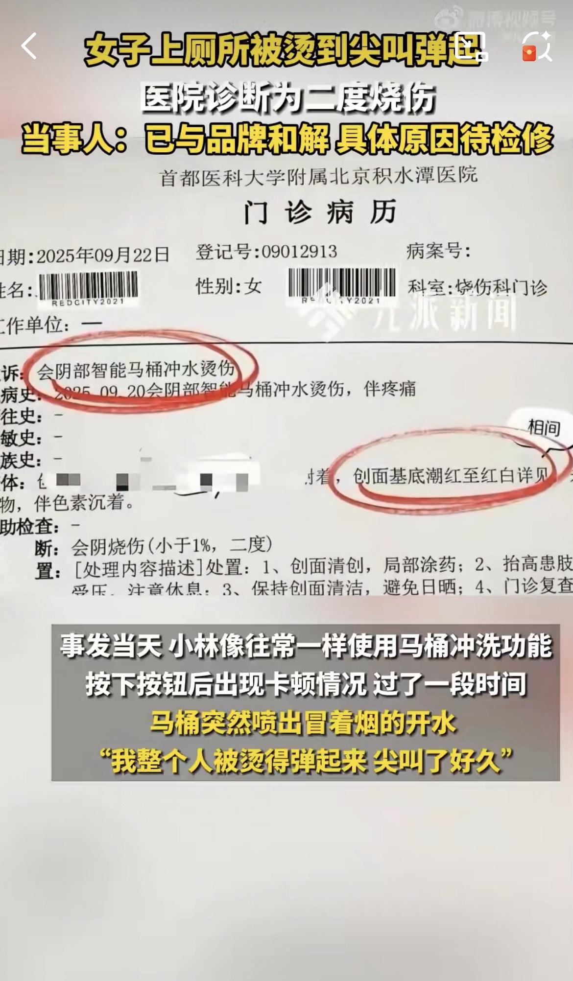 上厕所时被自家智能马桶喷开水烫伤，这事儿听着离谱，却真真切切发生在了一个普通女生