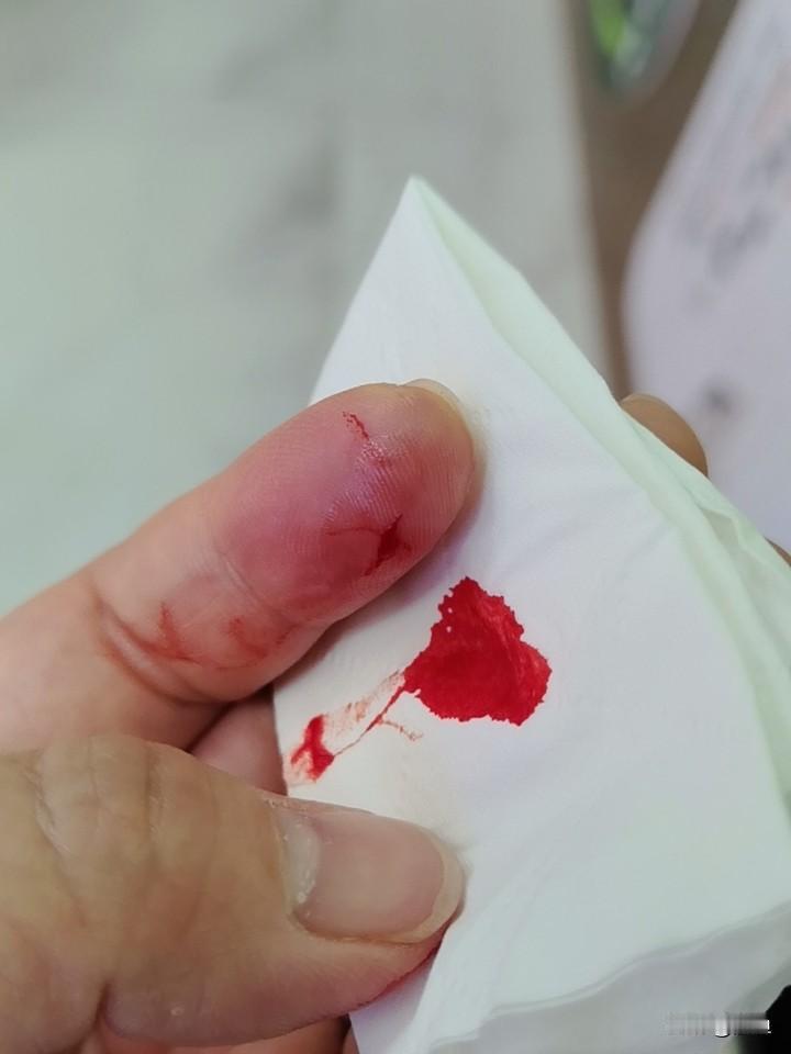 善良给你带来了什么善良给我最大的就是伤害。。。总是受伤[哭哭][哭哭][哭哭][