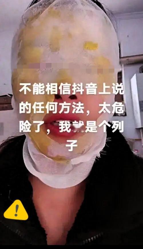 邯郸一女子模仿网络“妙招”，白糖加白醋烧开除水垢，被沸水烫伤面部水垢难除？河