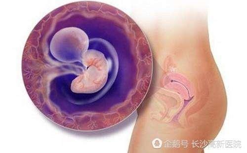 细说: 试管婴儿着床失败的那些胚胎去哪儿了?