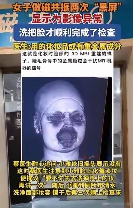 让人哭笑不得！福建一29岁女生头晕，去医院做头颅磁共振。不料，连续2次扫描，都因