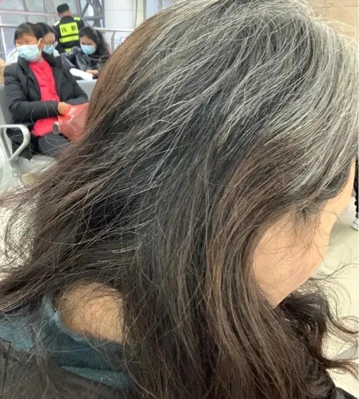 我正在为一件事纠结。我74年的，白发特别多，头顶几乎全白了，这两个月，我要参加三
