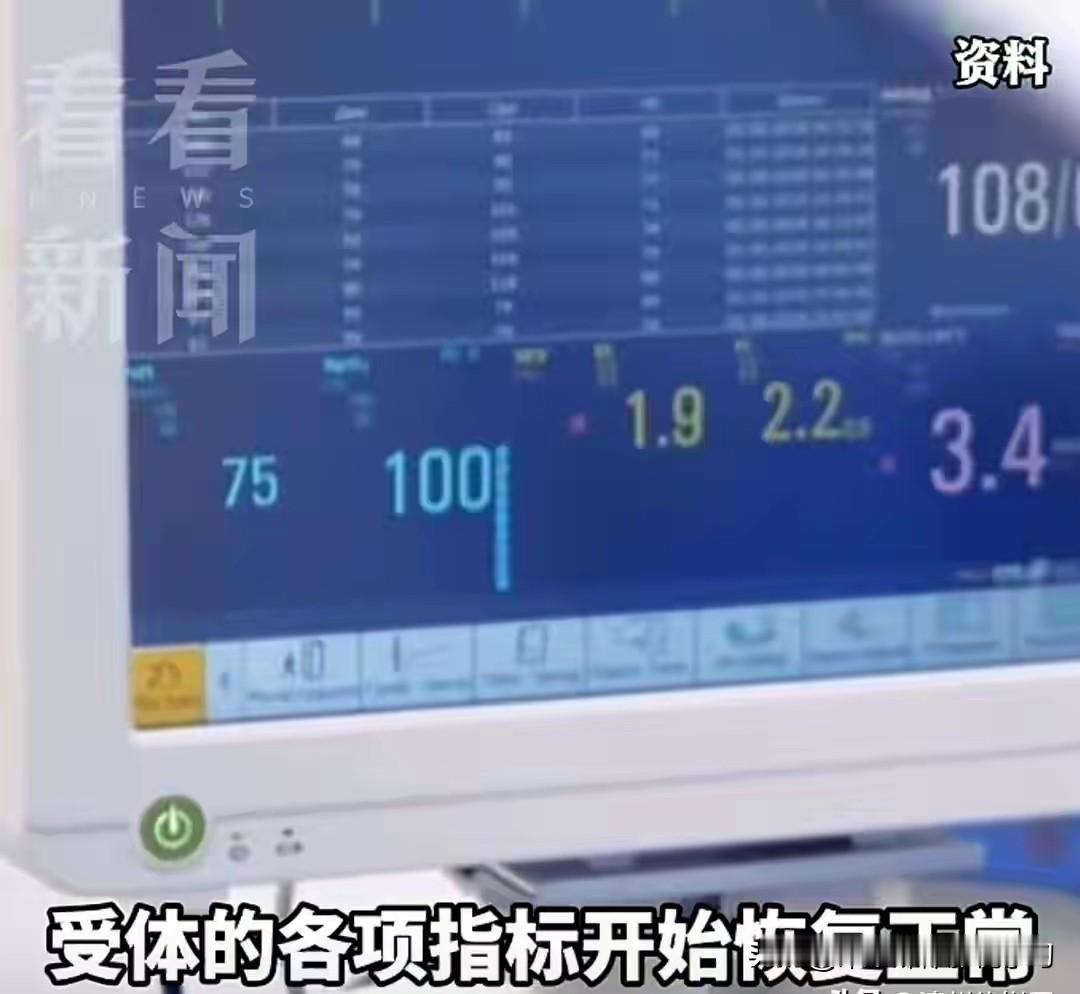 猪肝猪肾同时在人体内“上岗”，中国医生这波操作，让全球震撼！最近，国际顶尖期
