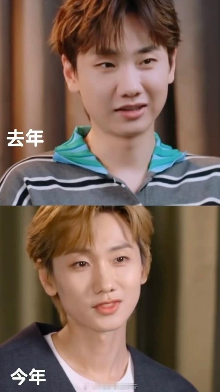 男的也一样，看汪苏泷瘦下来之后法令纹都没了。。。​​​