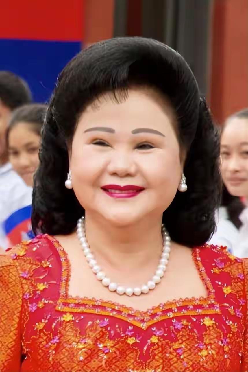 洪森的老婆文拉妮女亲王，这双眼皮儿绝对是割的。只是割的太失败了，双眼皮比眼睛都