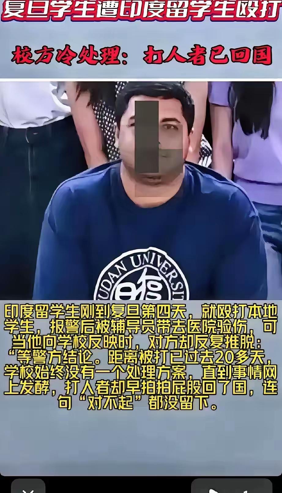 好好的校园，自家学生平白无故遭外籍交流生动手，换谁心里都堵得慌。受害者完整留存报