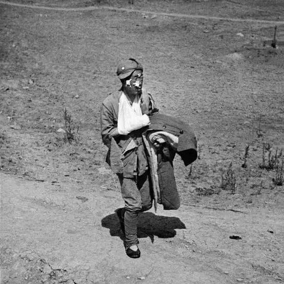 台儿庄，一位刚下火线的战士，有包扎，有棉衣，应该是嫡系部队的吧。不知