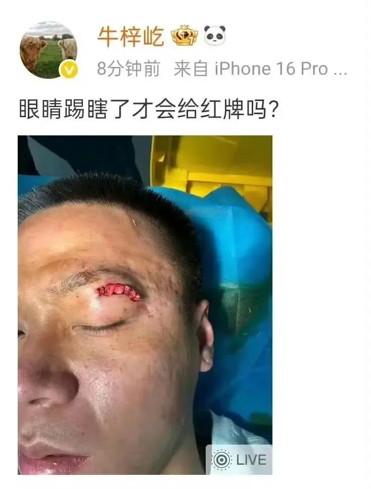 【中超第十轮双标判罚继续！｜国安进球前对“射正亡”犯规，裁判判定进球有效！牛梓屹