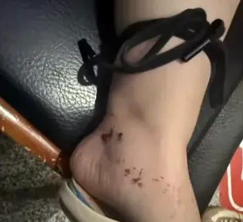 太吓人了！妻子刚出电梯就被毒蛇咬伤！近日，重庆一小区居民赵女士刚出电梯就被盘踞在
