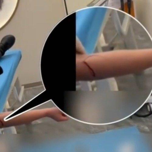 刷到一条新闻差点把手机摔了——上海松江有个“健康咨询”窝点，居然用长针给顾客“放