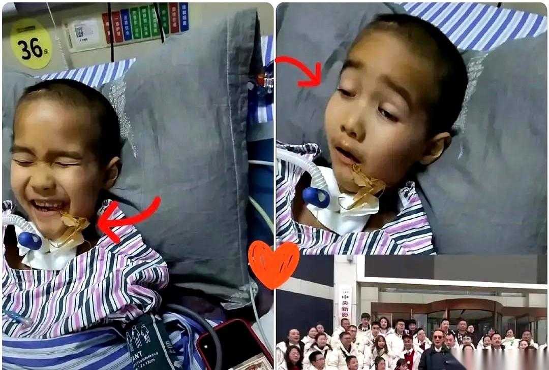 脑干出血30毫升。医生说，能醒过来，就是跟阎王爷掰了一次手腕，还赢了。结果他