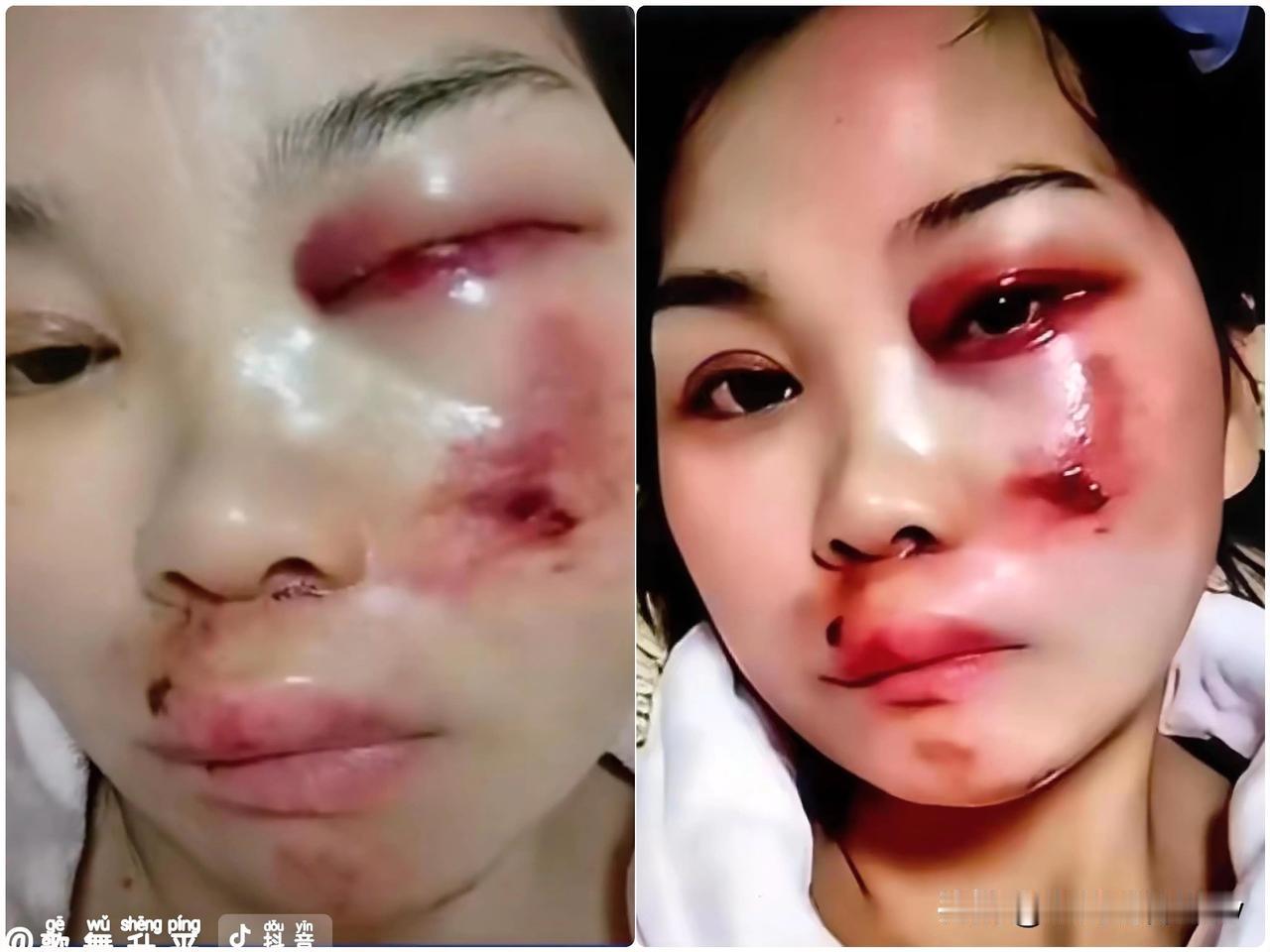 200万播放的家暴视频，评论区却刷满了活该？襄阳这位女士的经历，真的让人五味杂陈