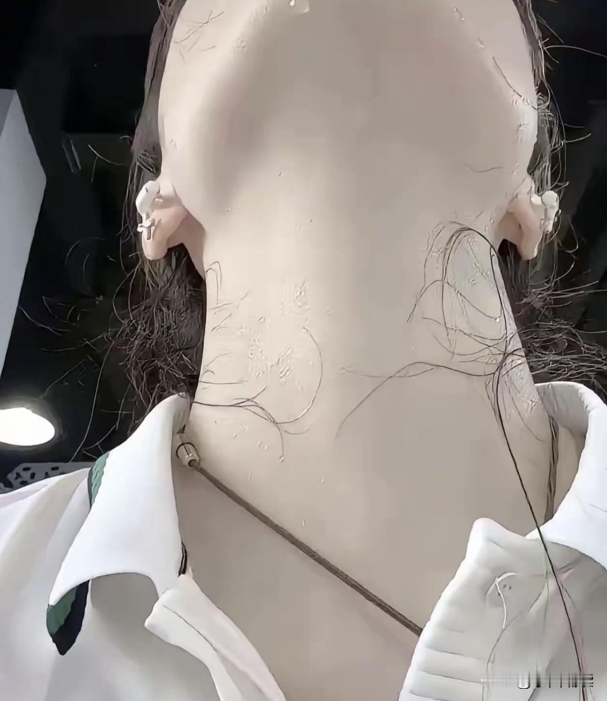 都说一白遮百丑,但太白了是不是显得不健康啊?