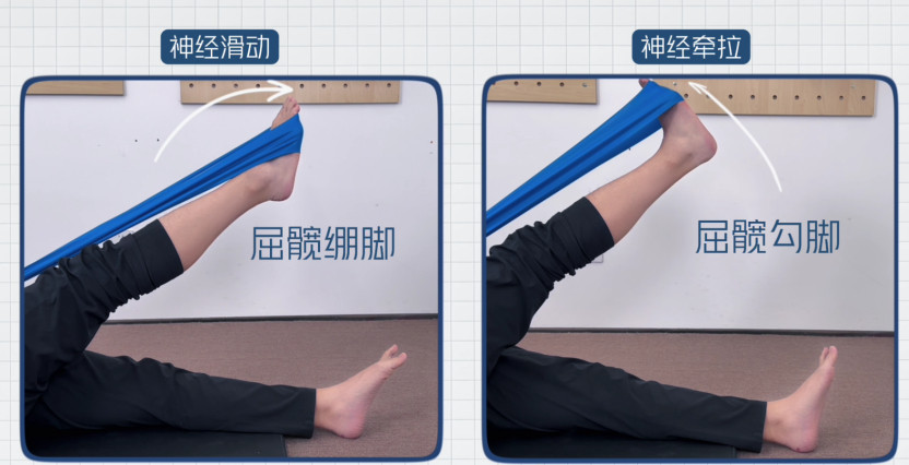 坐骨神经痛你是否有过屁股疼、屁股麻、腿麻、脚麻？其实这很可能和我们的坐骨神经受