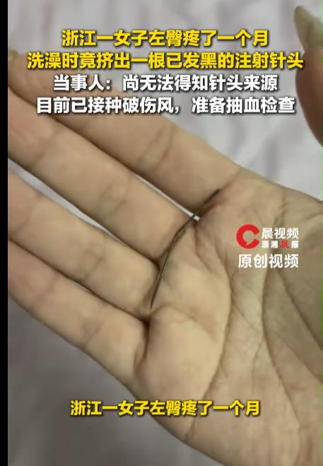 “以后还敢坐共享单车吗？”浙江温州，一女子左臀疼了整整一个月，以为是运动拉伤一直
