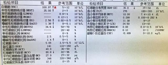 越来越多孩子得白血病？医生坦言：家里4样东西是祸根，趁早扔了。白血病在儿童