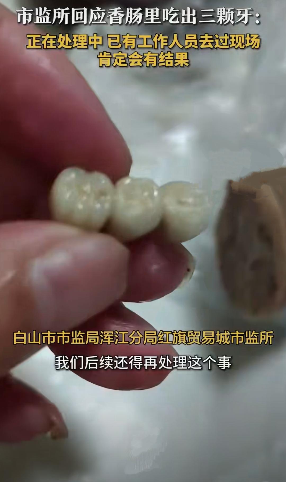 吉林白山一位市民在红旗贸易城北门口摊位购买的香肠里，吃出了三颗完整的人类牙齿。这