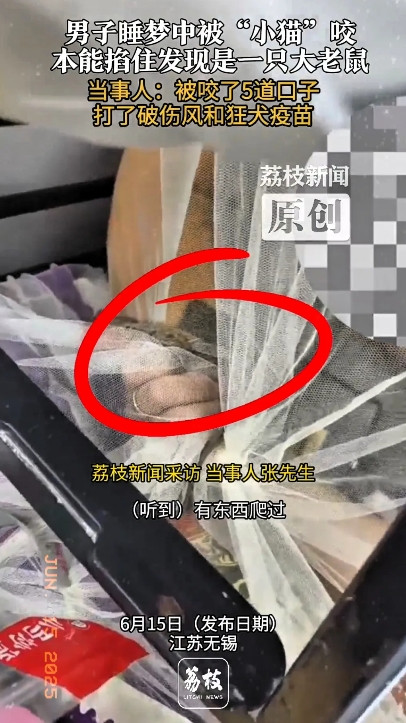 “太后怕了！”江苏无锡，一男子睡梦中感觉手边有什么东西爬过，毛绒绒的，他以为是家