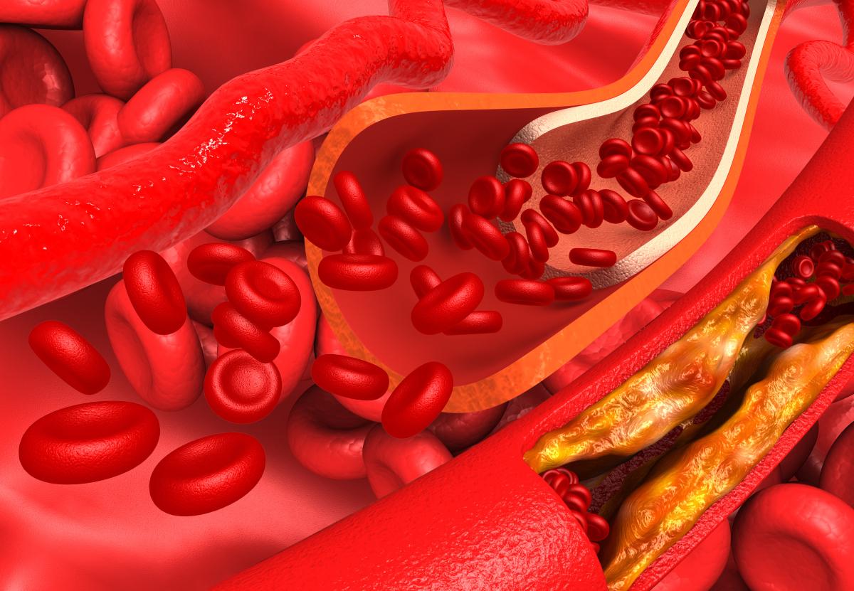 家家都有！这不起眼食材是血管“疏通剂”，9成人吃错，白白浪费好东西！家家都