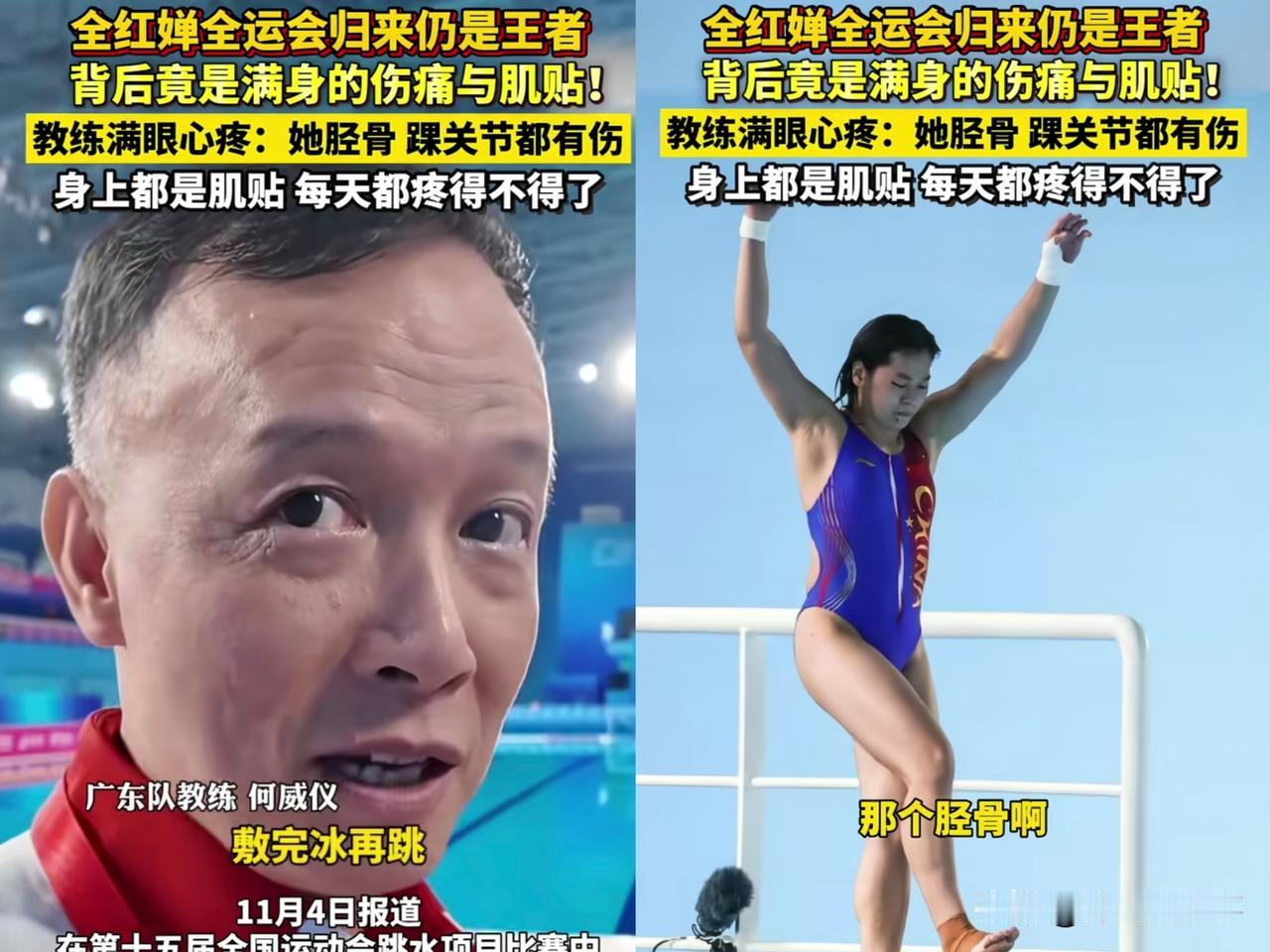 终于有人说出全红婵的秘密了！你别看全红婵归来仍是王者的样子，其实她的伤一直都