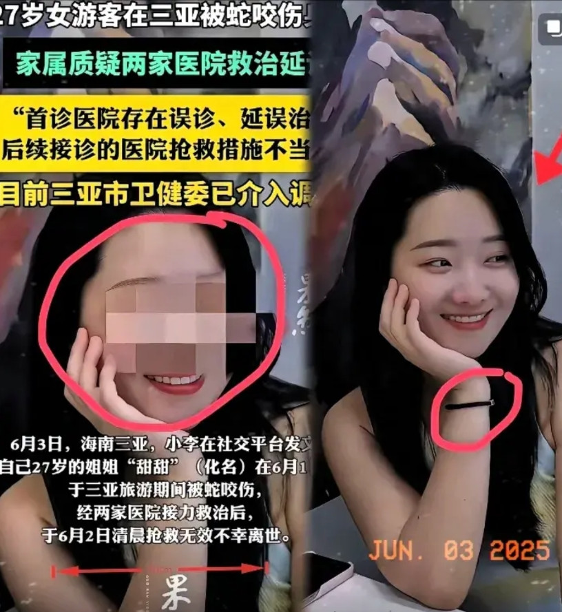 三亚游客被蛇咬这事件提醒我们！一定要注意几个事项蛇咬之后，先别急着跑，免