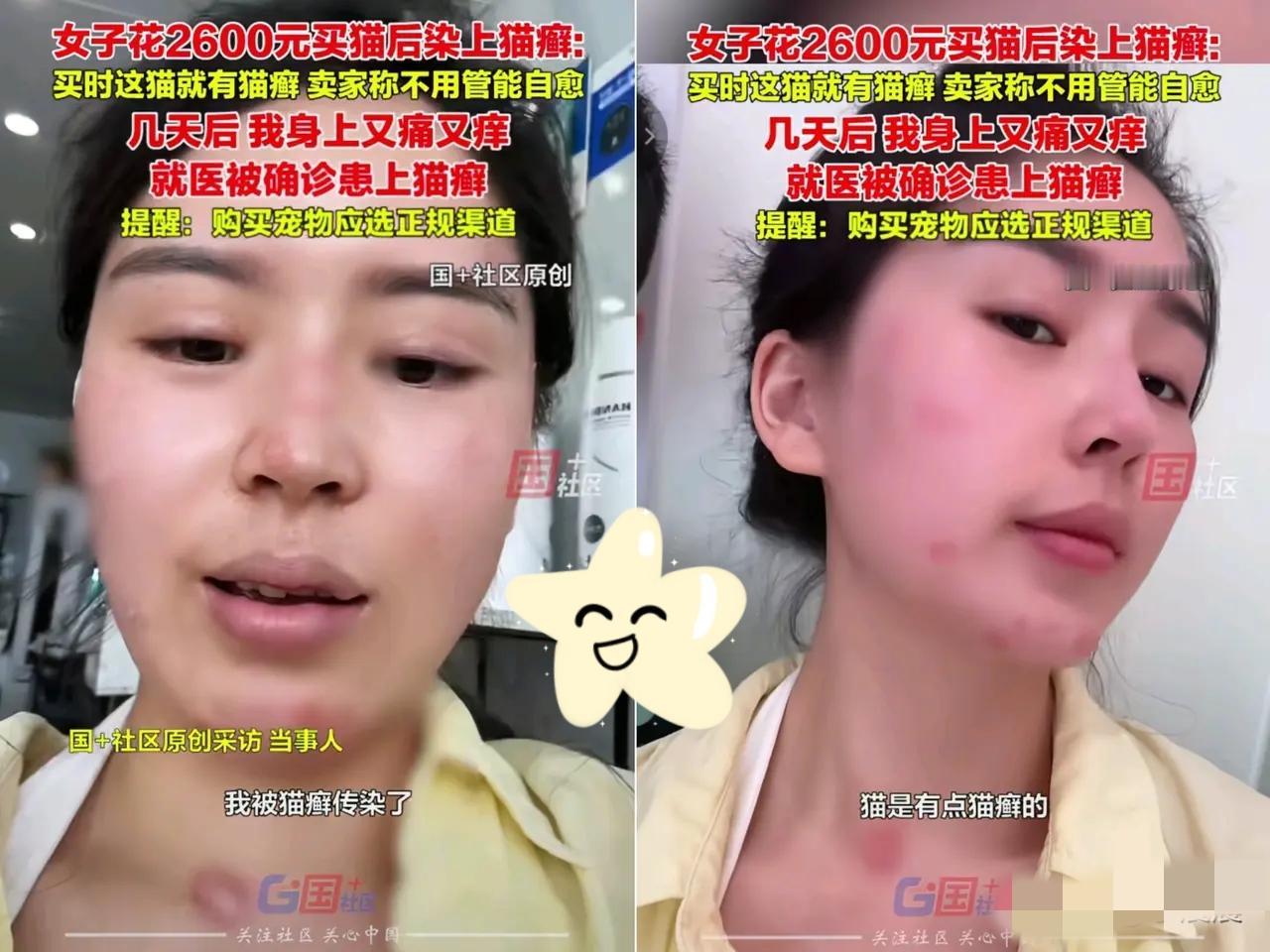 崩溃了！嘉兴女子花2600块买猫，明知猫带癣还信卖家“能自愈”，结果自己满
