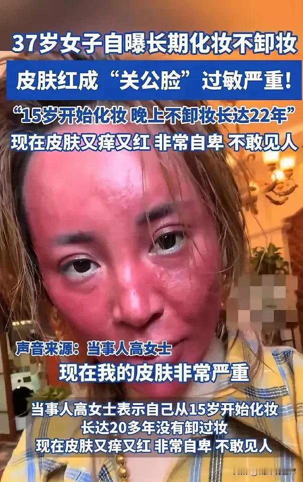 长期化妆不卸妆，到底有什么危害？有人不惜以身试险现身说法了：皮肤红成“关公脸