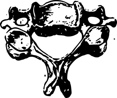 怎么判断是否脊柱侧弯 引起脊柱侧弯的原因
