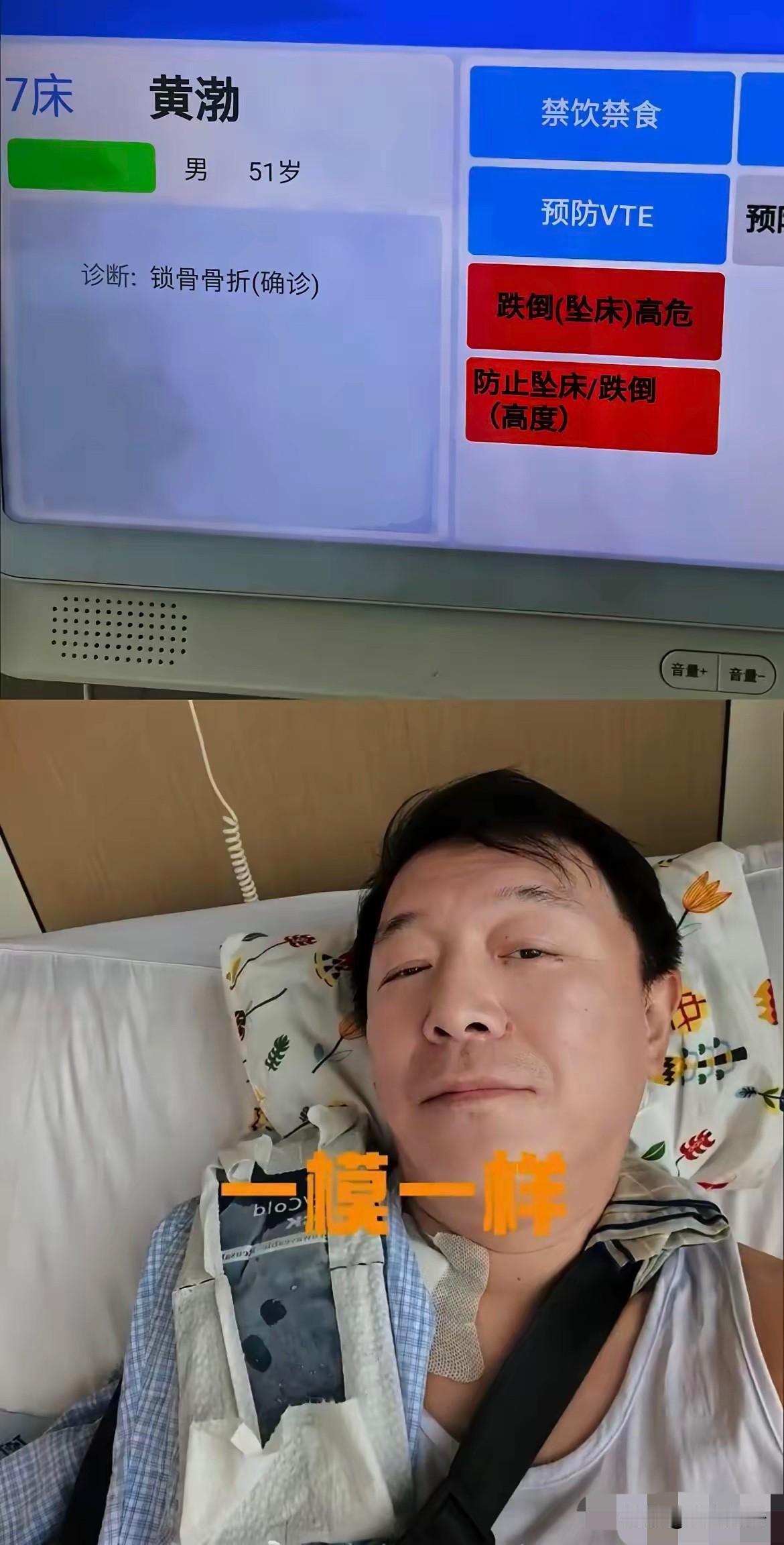 我朋友是骨科医生，跟我聊到黄渤这次骨折时，说了一句大实话：他说很多人都低估了这