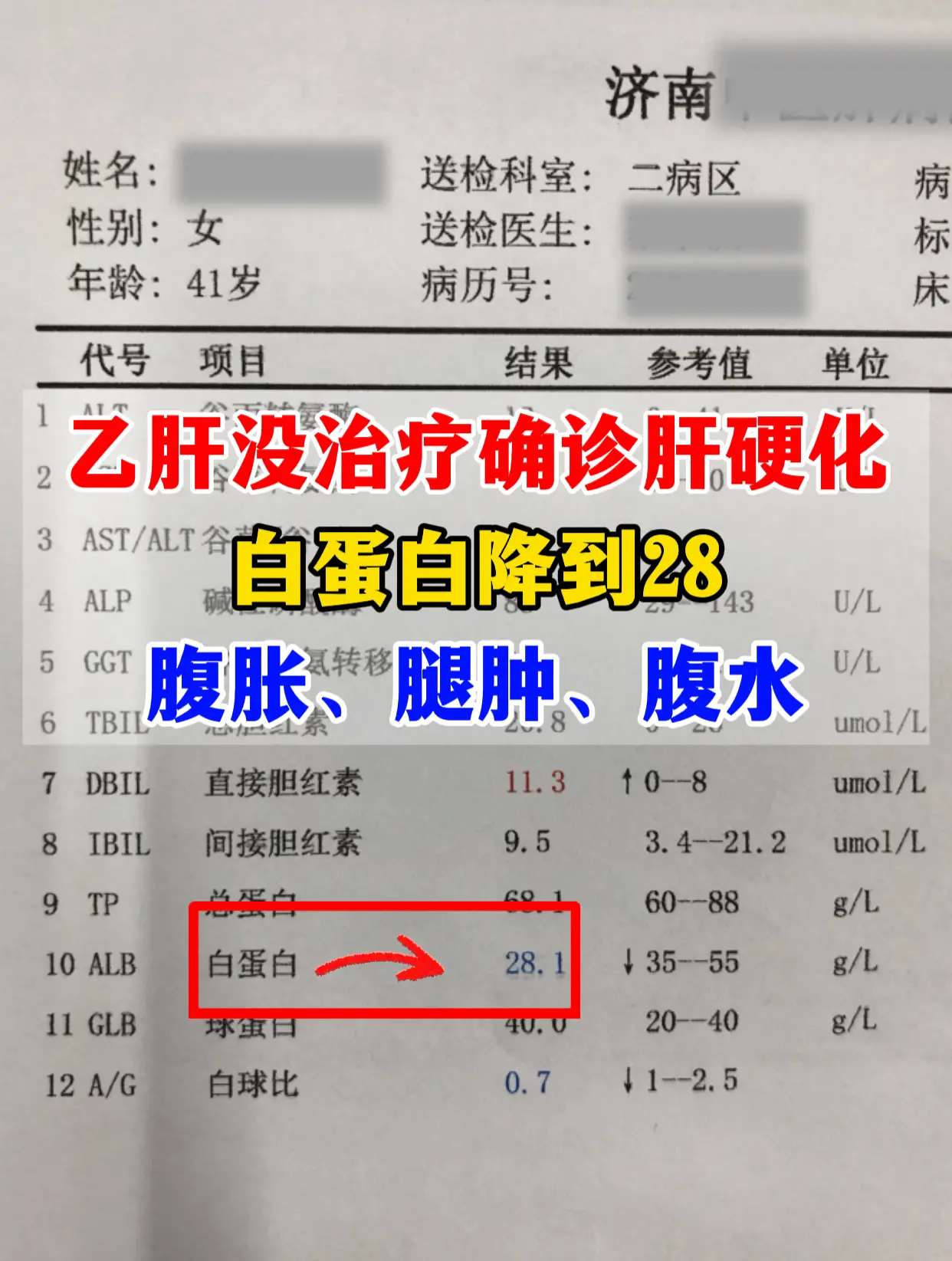 41岁的刘先生，一进门就唉声叹气的。问诊了解到他早年查出乙肝，觉得身体...