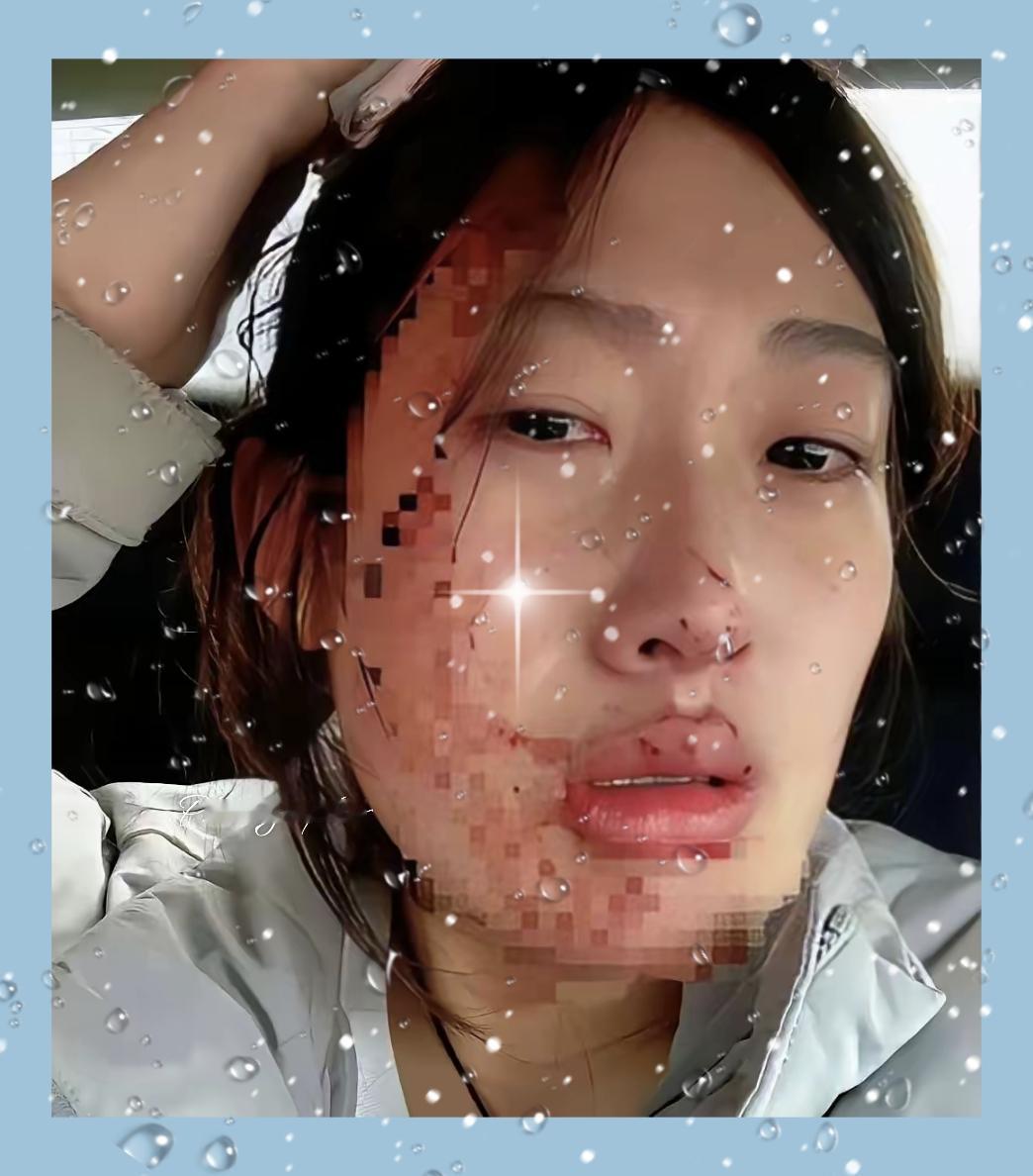 暴力的代价！23岁儿科护士刚入职不久，傍晚6点为感冒患儿输液时，三次穿刺均失败，