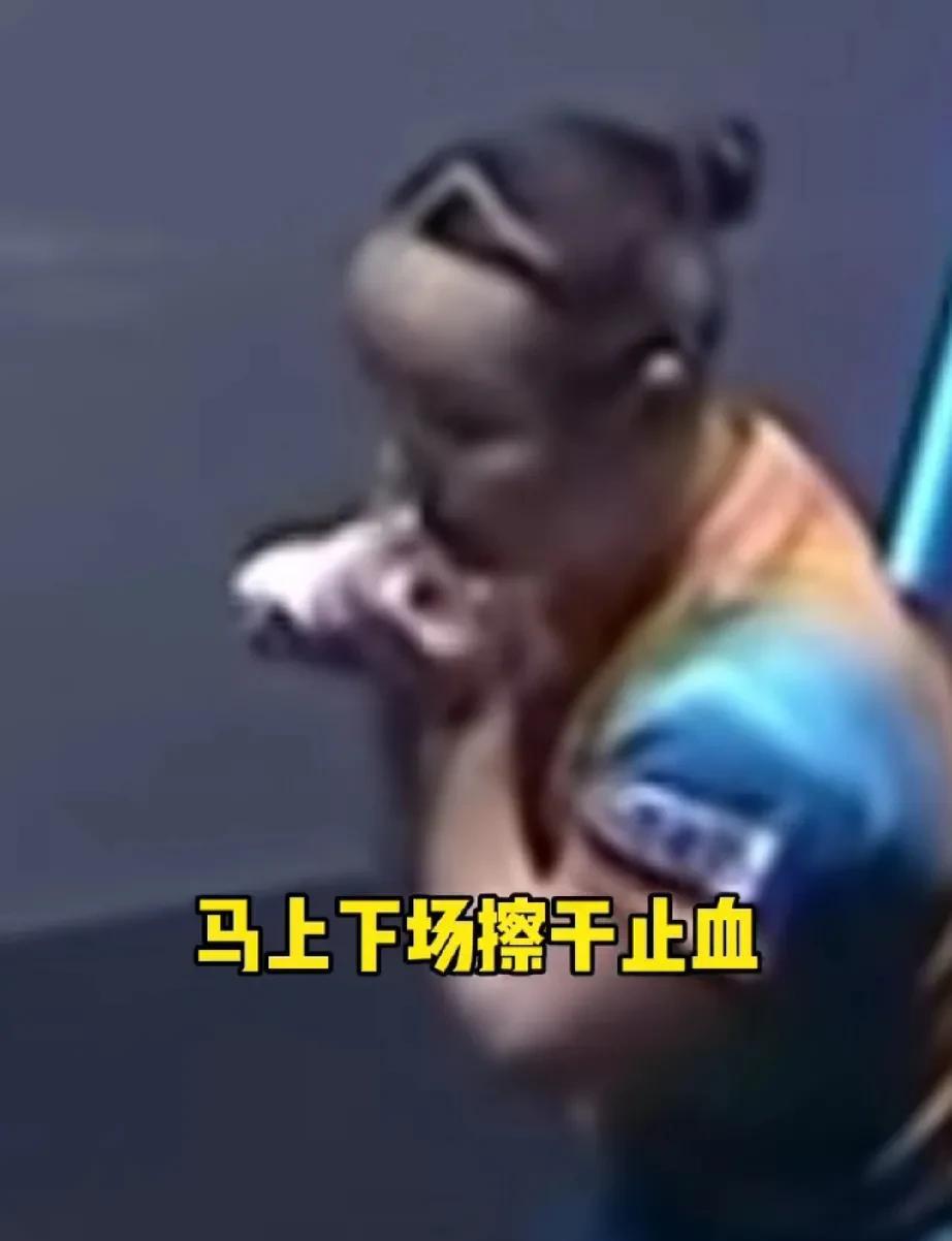 有人说:这种才是真的需要暂停处理，不像某些人～这才是真的需要医疗暂停[赞]张本