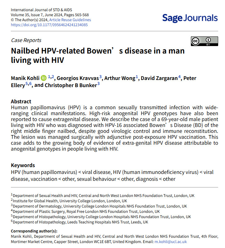 美甲工具混用有人感染HPV这绝对有可能，国内外都有报道。消毒不彻底可能感染HPV
