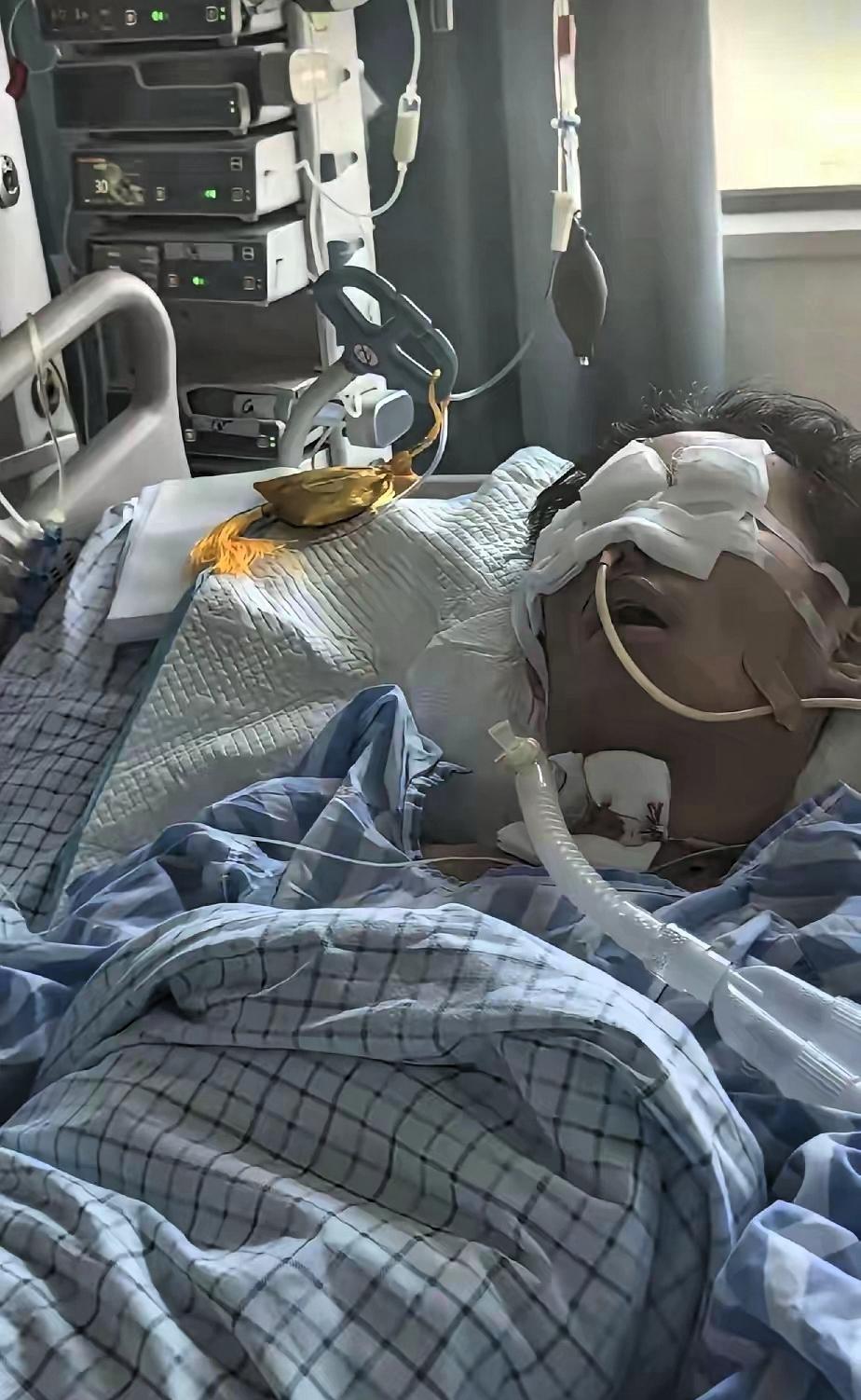 14岁陈佳铭已昏迷超30天，上海专家会诊后，确认无生还希望不过是校园里一次寻