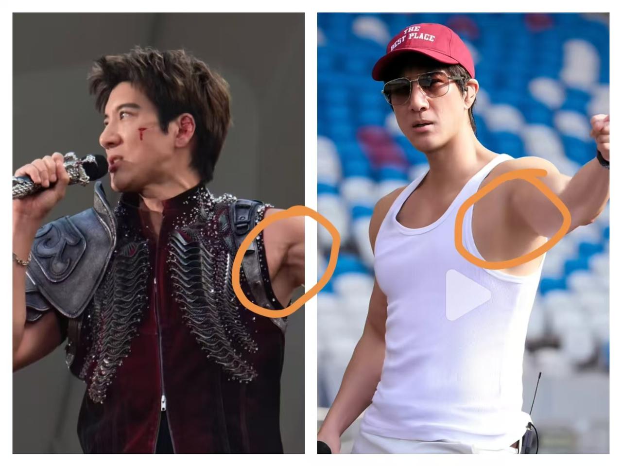 我承认我的关注点总是与众不同大家都在关心王力宏耳骨撕裂唯独我发现，一个5
