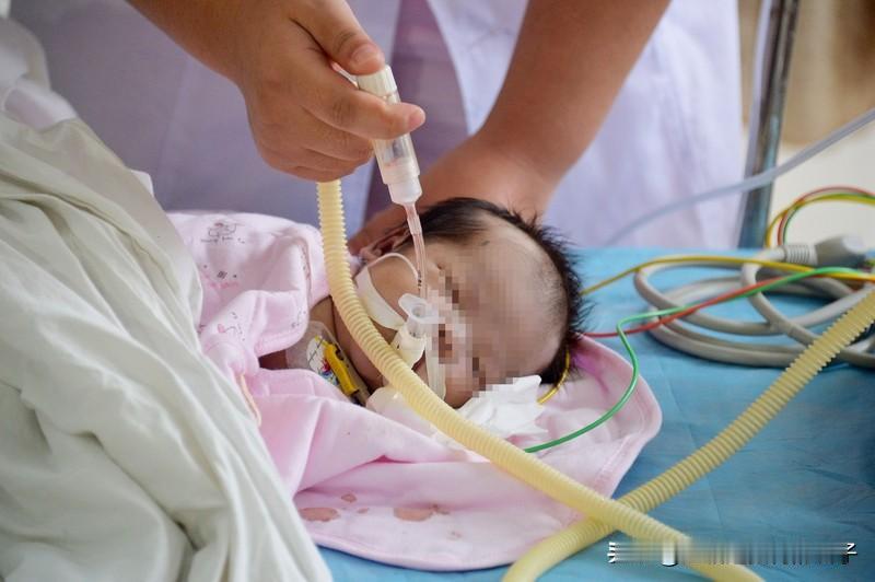5月龄女婴心脏手术离世眼挂泪痕太揪心了，宁波那个5个月大的早产女婴做心脏手术没