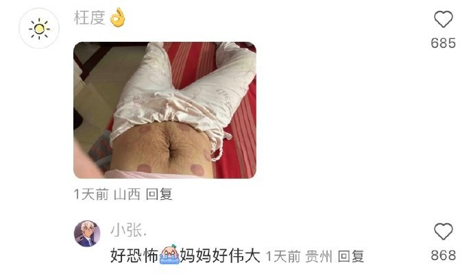 用一张图证明你生过小宝宝！