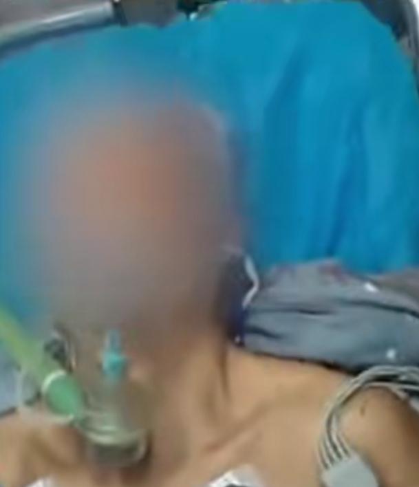 头部中枪了，不着急；让子弹飞一会，要淡定，先走回家再说。近日，河南一54岁男子