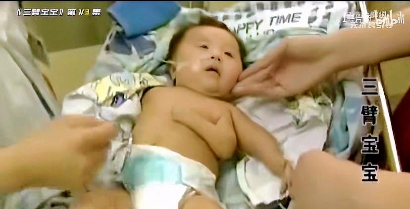 有些钱，真不是省出来的。21岁姑娘因为没钱做产检，孩子一出生就带着先天问题，医