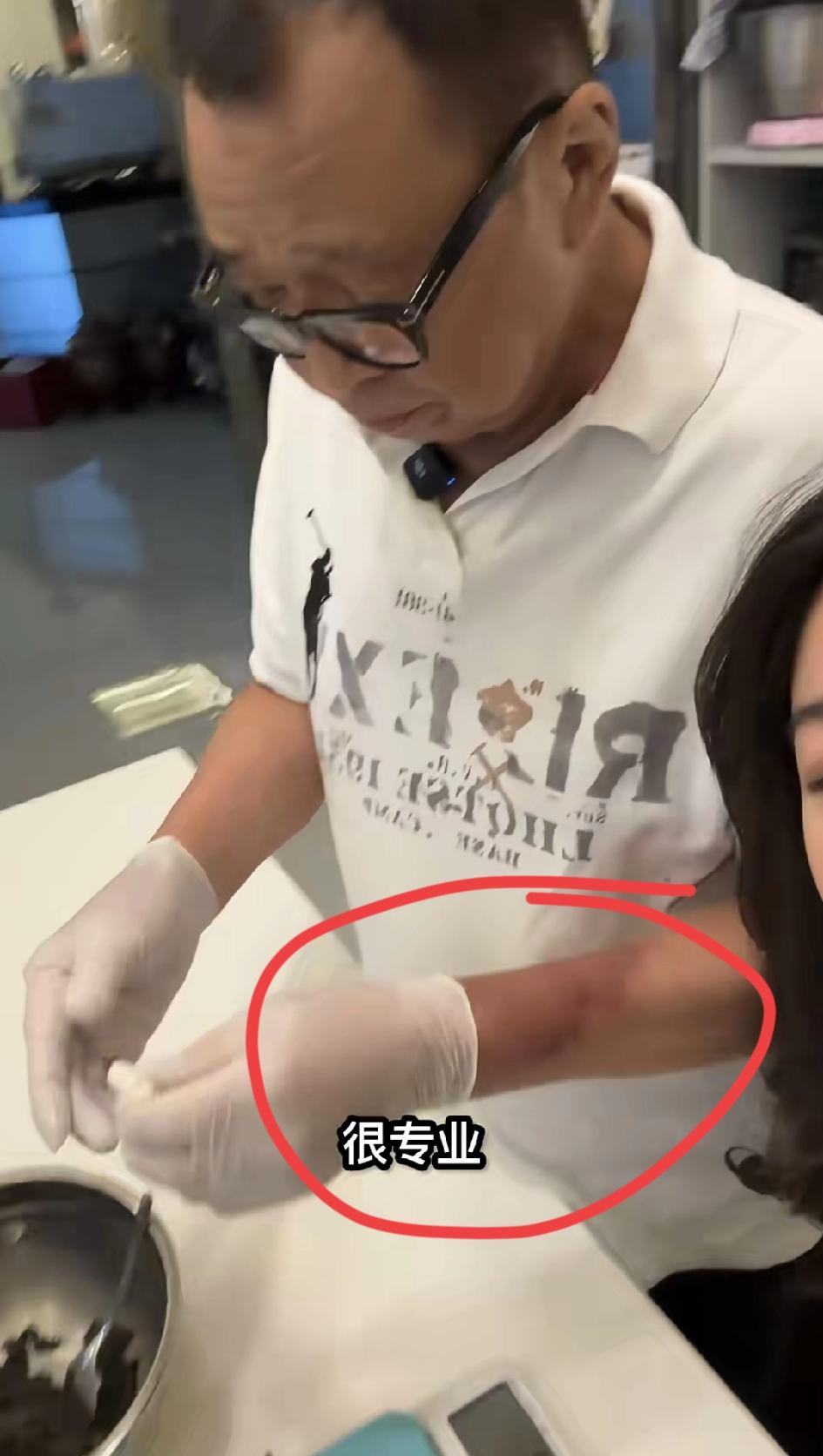 国庆期间许绍雄跟闺女在家做汤圆的视频里,有只手臂上有块不小的红斑,查看其他视频里