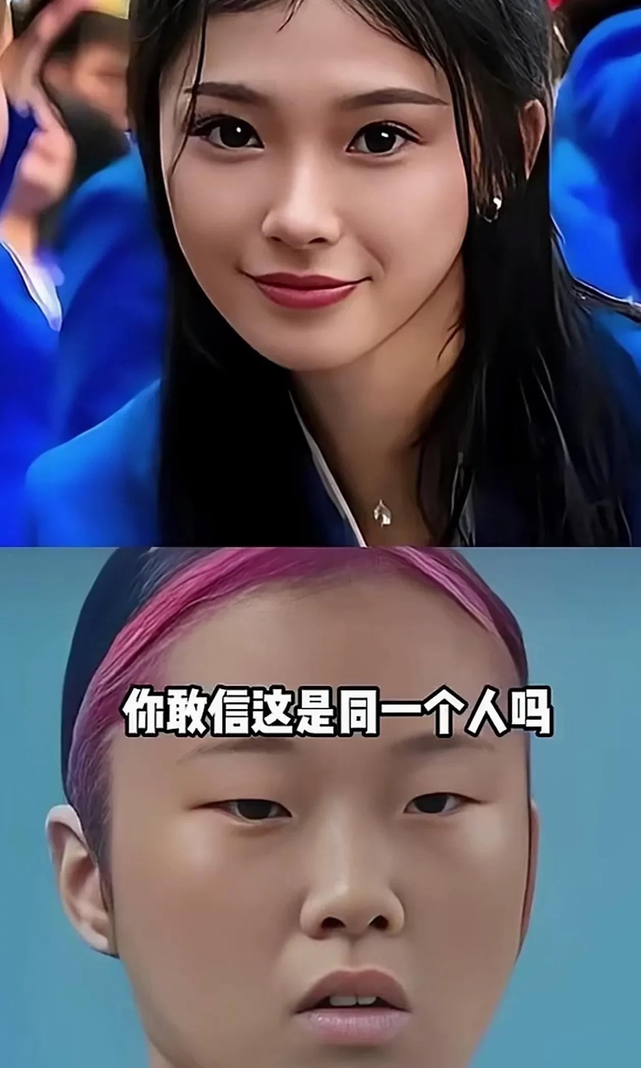 吴艳妮割了双眼皮后确实好看了很多，其他地方应该都没变，以前就是眼睛小点，别的五官