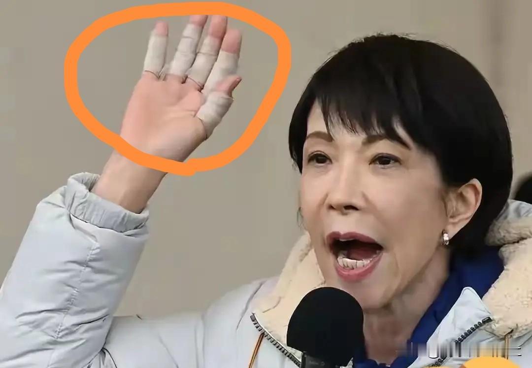 恶人自有恶病磨！高市早苗的风湿性关节炎越来越严重了，是不是觉得活该？来自日本