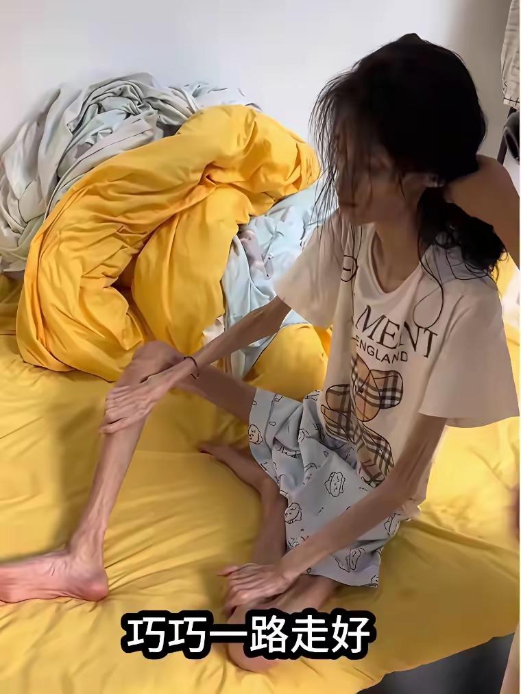 天哪，为啥会瘦成这么一副皮包骨头的，到底她得了什么病？