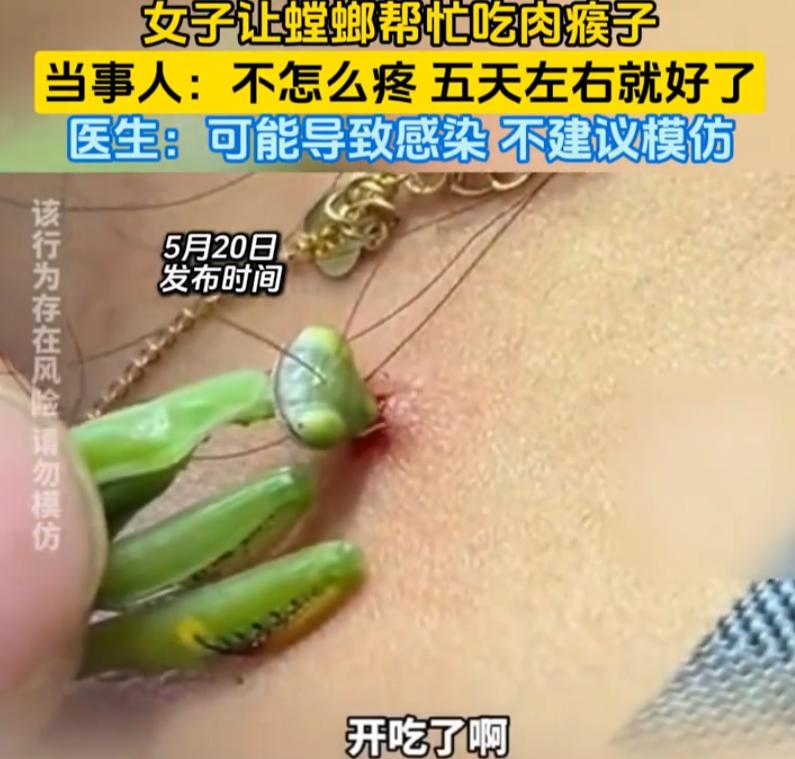 四川成都，脖子上长了个肉瘊子，不大，但挺碍眼。她一直纠结：去医院吧，感觉有点小题