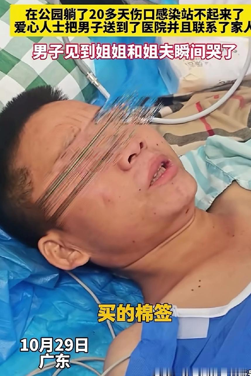 男子腿上长了一个鸡蛋大的瘤子，自己考虑许久下决心买来刀片和消毒水把腿上的瘤子割掉